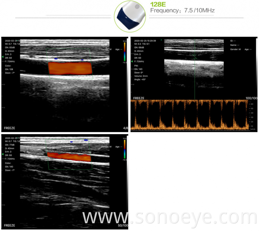 Linear Color Sonostar Pocket Ultrasound Wireless Probe